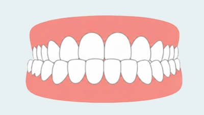 Articulé croisé
